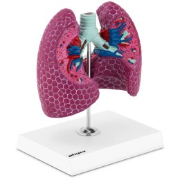 Model anatomiczny 3D płuca człowieka ze zmianami chorobowymi